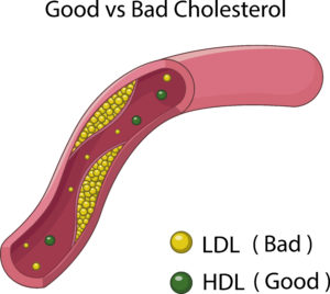 Good vs. Bad Cholesterol - weight loss tea Thor's Body Science